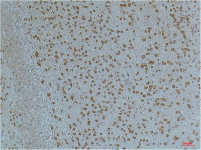 KCNV2 Antibody