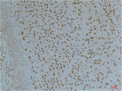 KCNV2 antibody