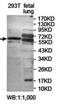 KCNV2 Rabbit Polyclonal Antibody