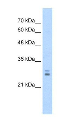 KCTD11 antibody
