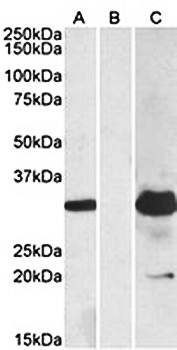 KCTD11 antibody