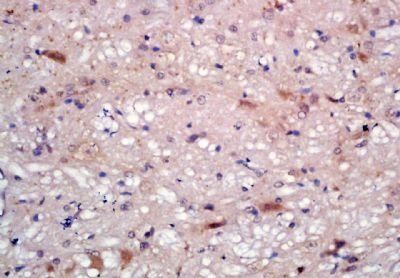KCTD12 Rabbit Polyclonal Antibody