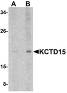 KCTD15 Antibody