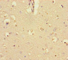KCTD16 Antibody