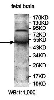 KCTD16 Rabbit Polyclonal Antibody