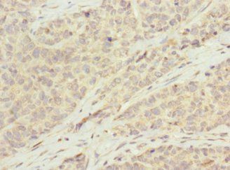 KCTD19 antibody