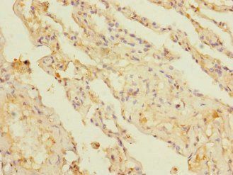 KCTD6 Antibody