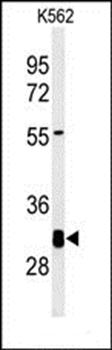 KCTD7 antibody
