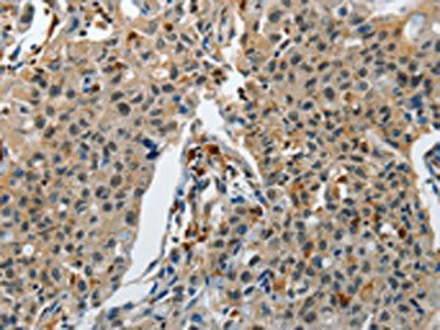 KDM1A Antibody