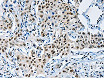 KDM1A Antibody