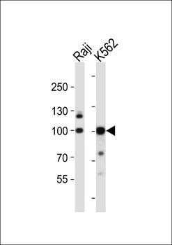 KDM1B antibody