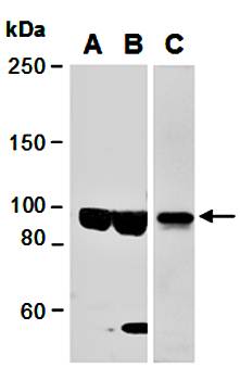 KDM1B antibody