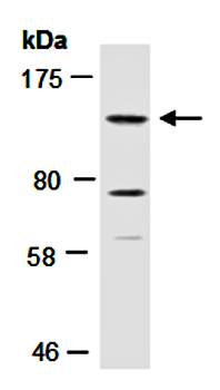 KDM2A antibody