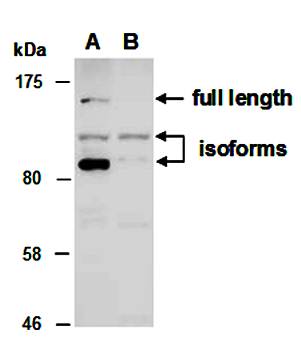 KDM2A antibody