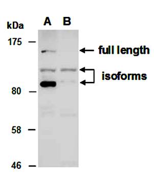 KDM2A (N) Antibody, Rabbit Polyclonal