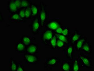 KDM2B Antibody