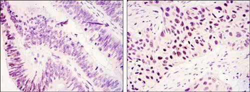 KDM3A Antibody
