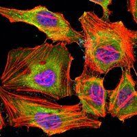 KDM3A Antibody