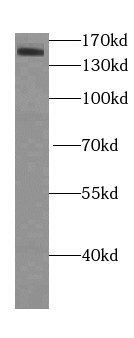 KDM3A,JMJD1A antibody