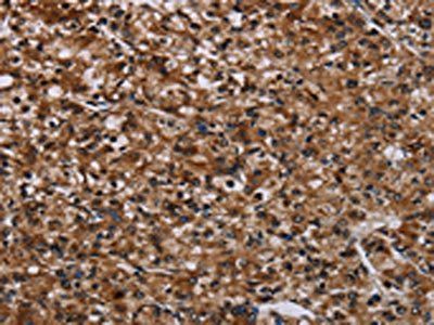 KDM3B Antibody