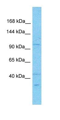 KDM4A antibody