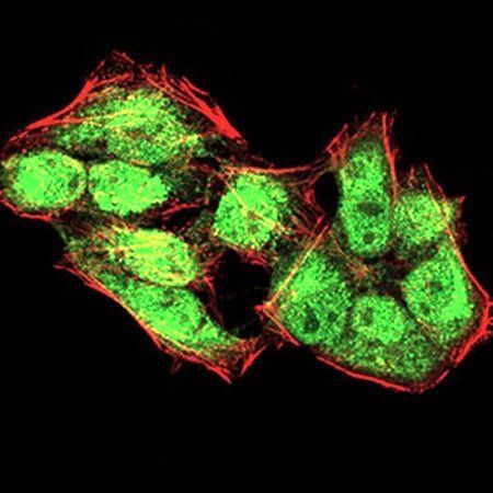 KDM4A Antibody