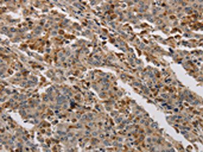 KDM4A Antibody