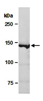 KDM4A antibody