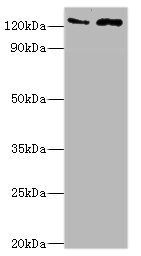 KDM4B antibody