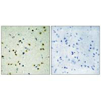 KDM4B Antibody