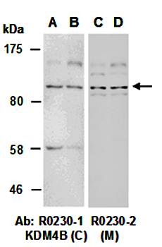 KDM4B antibody
