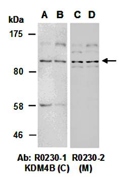 KDM4B antibody