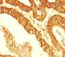 KDM4C Antibody