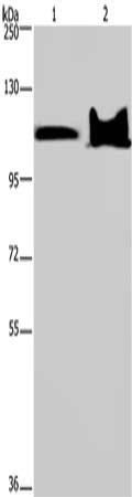 KDM4C Antibody