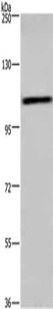 KDM4C Antibody