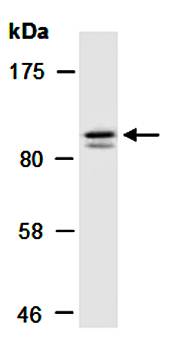 KDM4C antibody