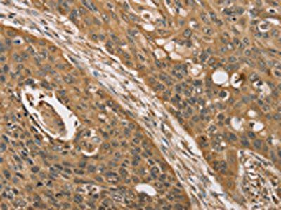 KDM5A Antibody