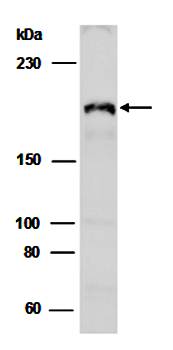 KDM5A antibody