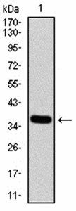 KDM5B Antibody