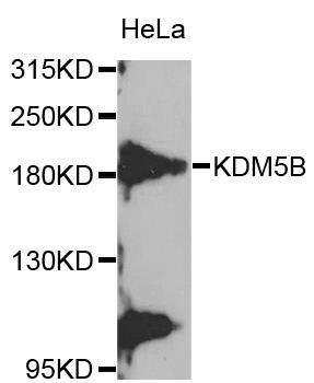 KDM5B antibody