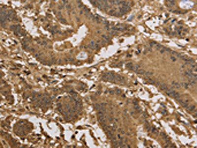 KDM5B Antibody