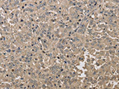 KDM5B Antibody