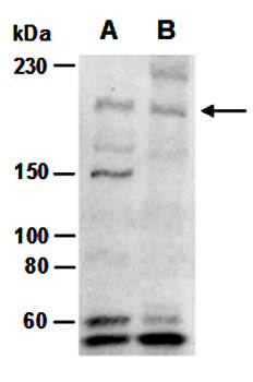 KDM5B (N) Antibody, Rabbit Polyclonal