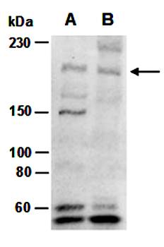 KDM5B antibody