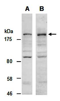 KDM5C antibody