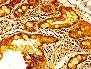 KDM6A Antibody
