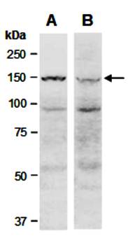 KDM6A antibody