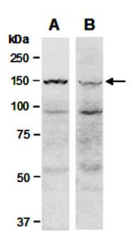 KDM6A antibody