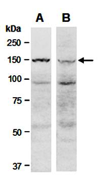 KDM6A (vPairTM) Antibodies