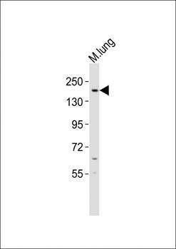 KDM6B antibody